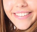 blanqueamiento dental chamartín